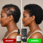 Load image into Gallery viewer, Huile naturelle pour stimuler la pousse des cheveux
