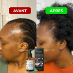 Load image into Gallery viewer, Huile naturelle pour stimuler la pousse des cheveux
