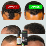 Load image into Gallery viewer, Huile Naturelle Booster Cheveux &amp; Barbe (Spécial Hommes)
